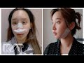 How my life has changed after 30 times of plastic surgery