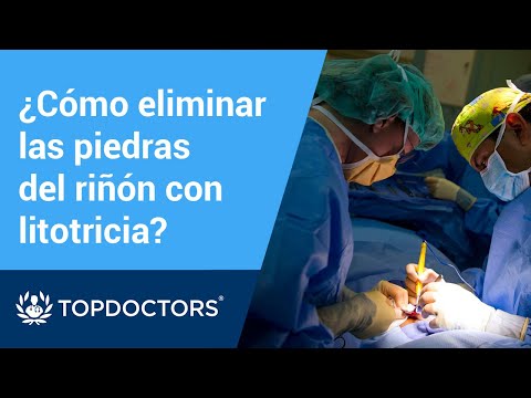 Video: ¿Qué significa litotricia?