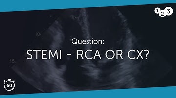 60 Seconds of Echo Teaching Question: STEMI - RCA or CX?