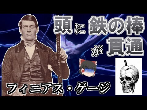 【ゆっくり解説】頭に鉄の棒が貫通した男-フィニアス・ゲージ　人間は脳の一部を破壊されるとどうなるのか？