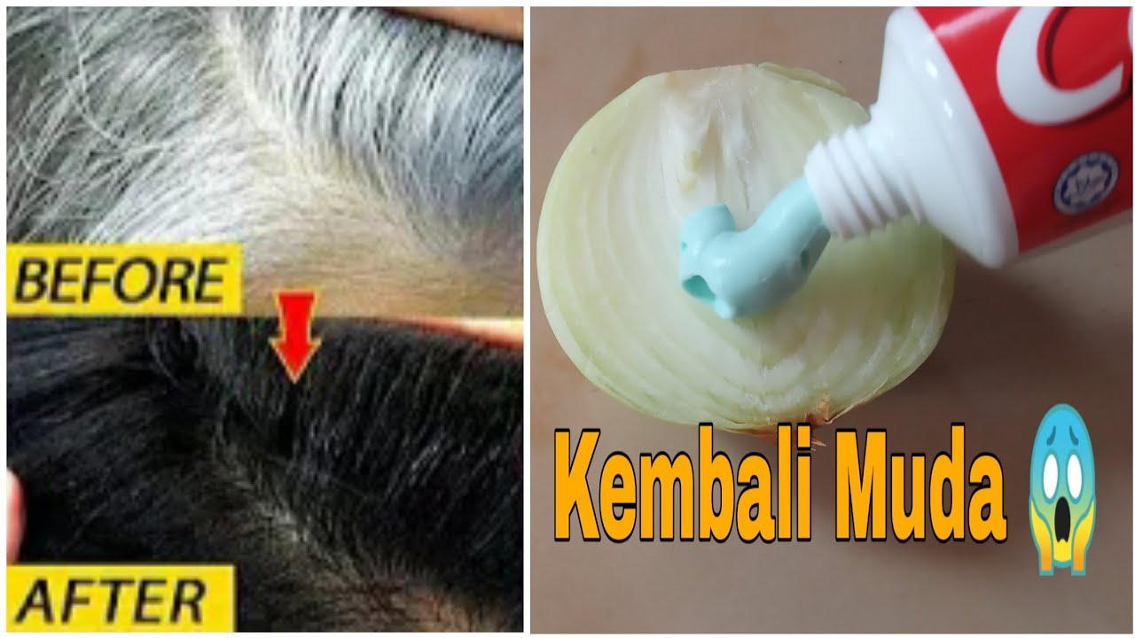 Khabar Baru Cara Cepat Menghilangkan Uban Hasil Permanen Selamanya Cara Mudah Bulan Agustus 2020 Jazz Indonesia