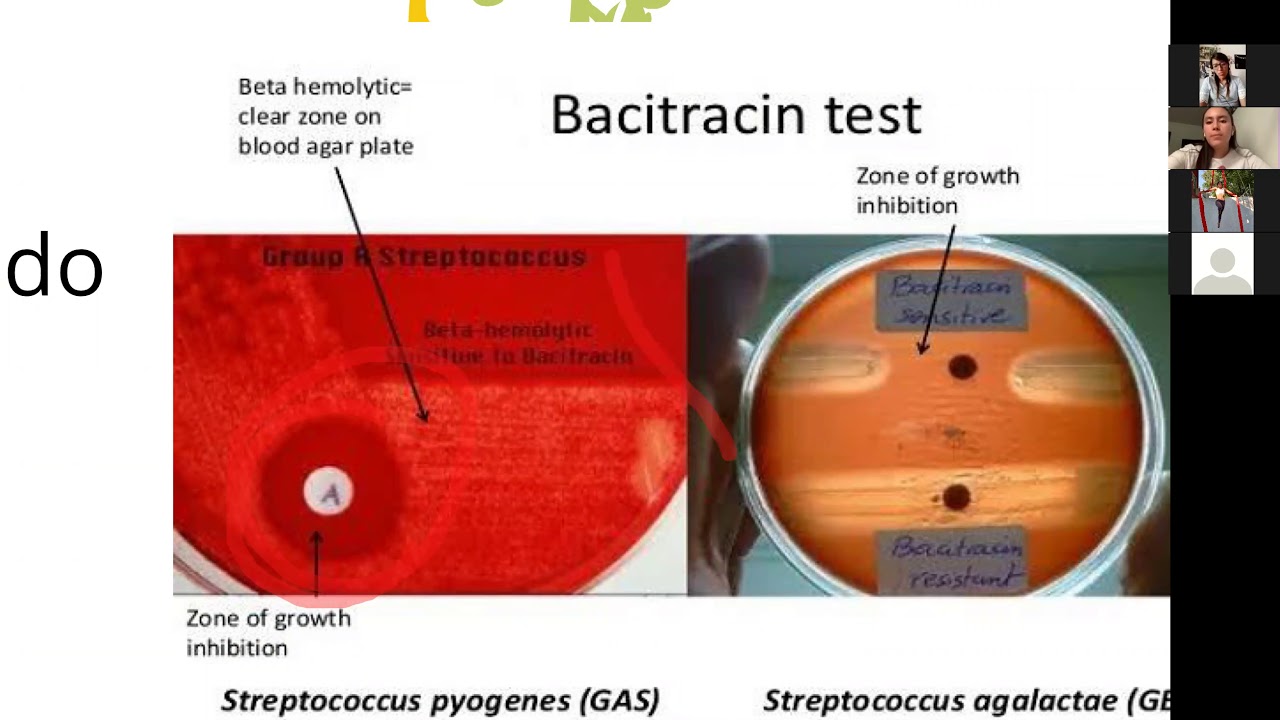 Clase Varicela Escarlatina Y Epmb 2 Dr Gallegos Youtube