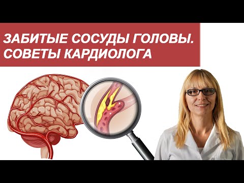 Забитые сосуды головы.