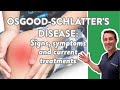 Osgood-Schlatter&#39;s disease: Signs, symptoms and current treatments