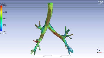 CFD through healthy lung airway - Flow streamlines at  the peak of inspiration
