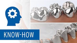 Ceramill Sintron - Everything is possible