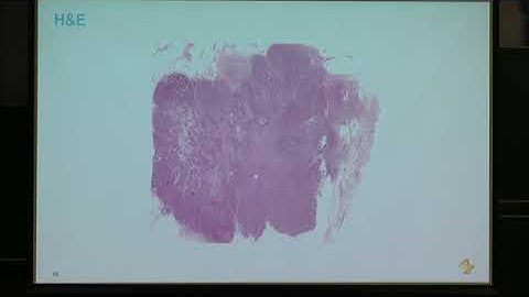 Ms. Yinhai Wang | Opportunities and Challenges in Multi-Model, Multi-Dimensional Image Analysis...