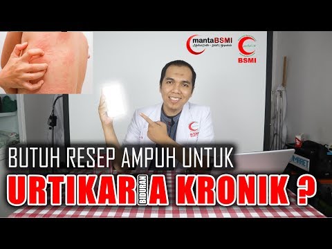 Video: Apa Yang Harus Dilakukan Ketika Antihistamin Berhenti Mengobati Sarang Kronis Anda