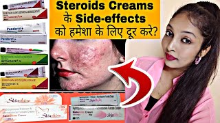 Steroid Creams Side effects & Recovery at Home ? | स्टेरॉयड क्रीम के साईड इफ्फेक्ट्स से कैसे बचे ?