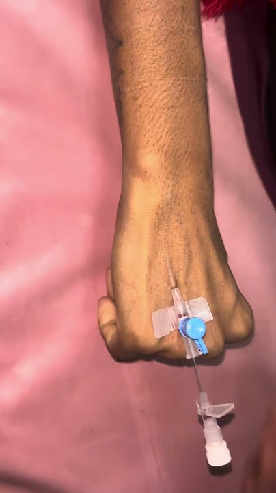I V Cannula insertion | Intravenous cannulation method #short #training #shorts #views #health