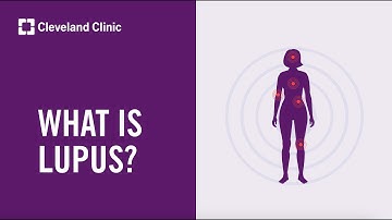 What Is Lupus?