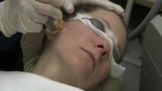 Laser Genesis Treatment