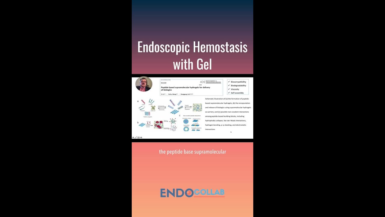 Endoscopic Hemostasis with Gel (e.g. Purastat)
