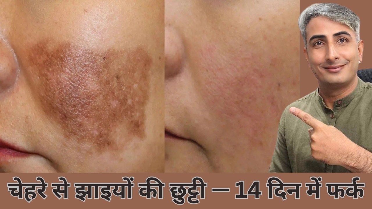 दाग-धब्बे हमेशा के लिए गायब I 14 दिन का चमत्कारी चैलेंज I DR. MANOJ DAS I #drmanojdas