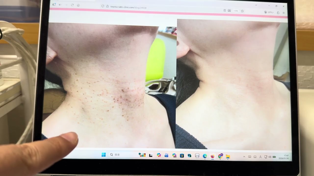 YouTube動画のサムネイル