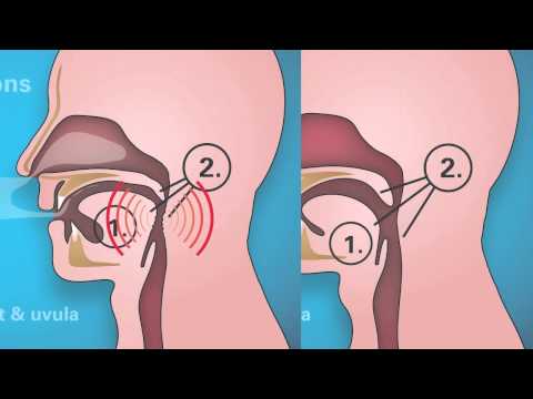 Somnowell snoring treatment