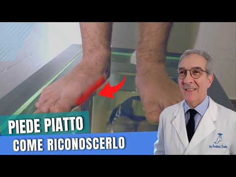 Video: Come capire se hai un piede piatto?