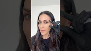 Mark Up With Me For My Full Face Tox My Favourite Day Is Btox Day