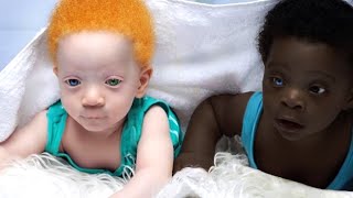 ¿Recuerdas A Los Gemelos Negros Con Colores Diferentes? ¡Esto Es Lo Que Les Pasó! by historias interesantes 14,209 views 2 days ago 15 minutes