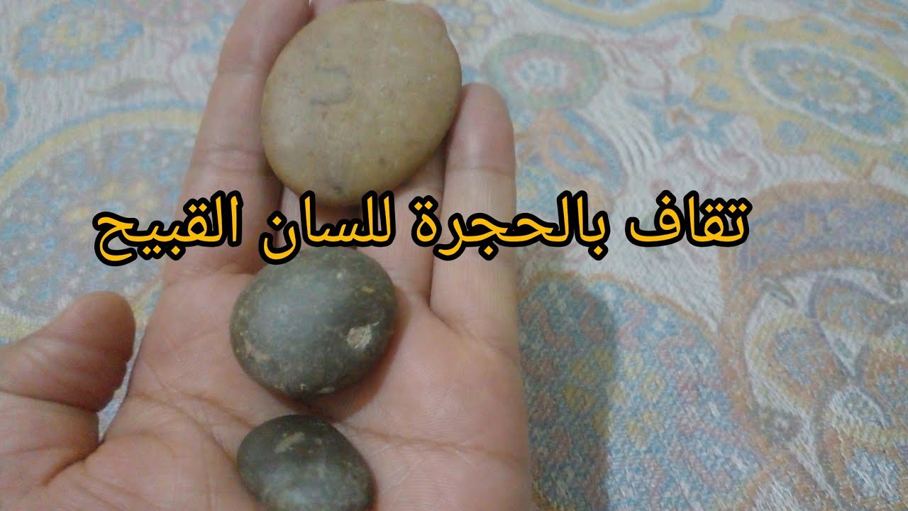 يالحجرة يالبكيمة بغيت عدويا مايقول تاكليمة👌