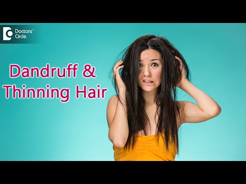 Combat Dandruff induced Hair loss with Homeopathy | HOMEOPATHIC CURE- Dr. Rashmi K | Doctors' Circle