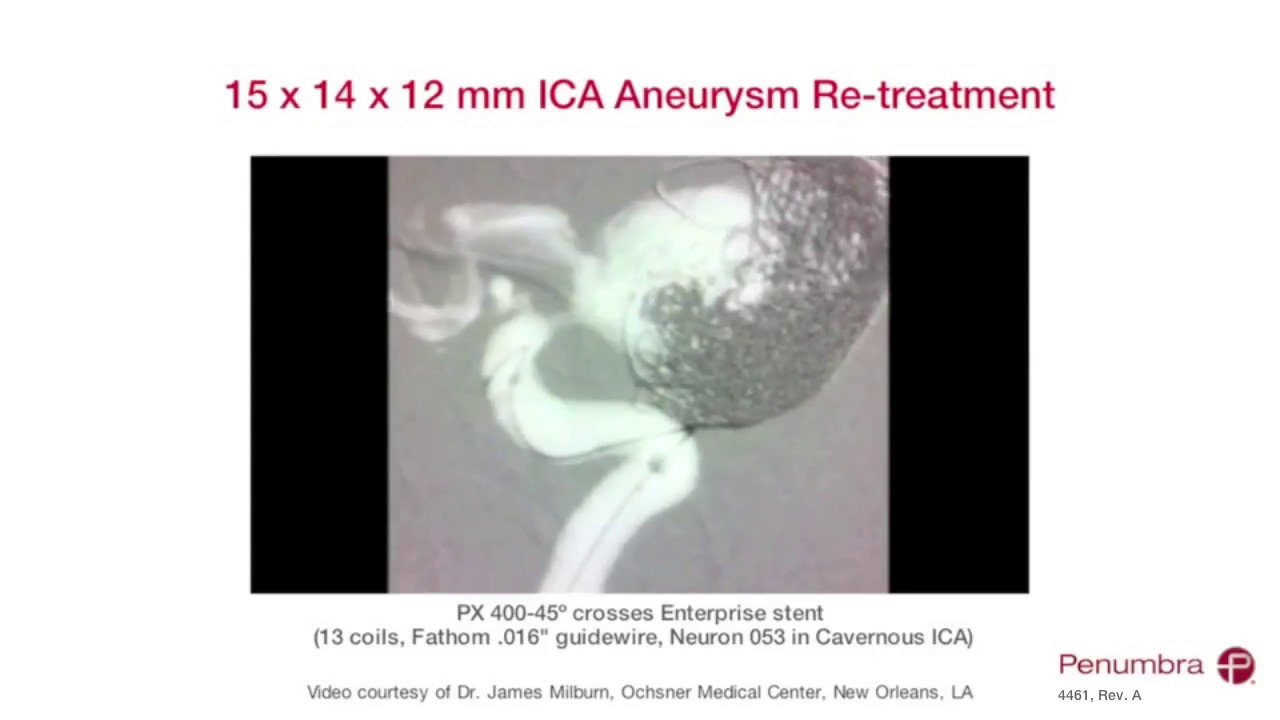 COIL PENUMBRA 400 YouTube