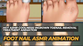 Hot Asmr Coolness Ingrown Toenail Removal Treatment Animation