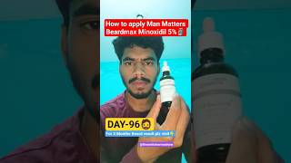 Man Matters Beardmax 5% Minoxidil: Day 96 Results! 😱 #shorts #beard #beardgrowth #viral