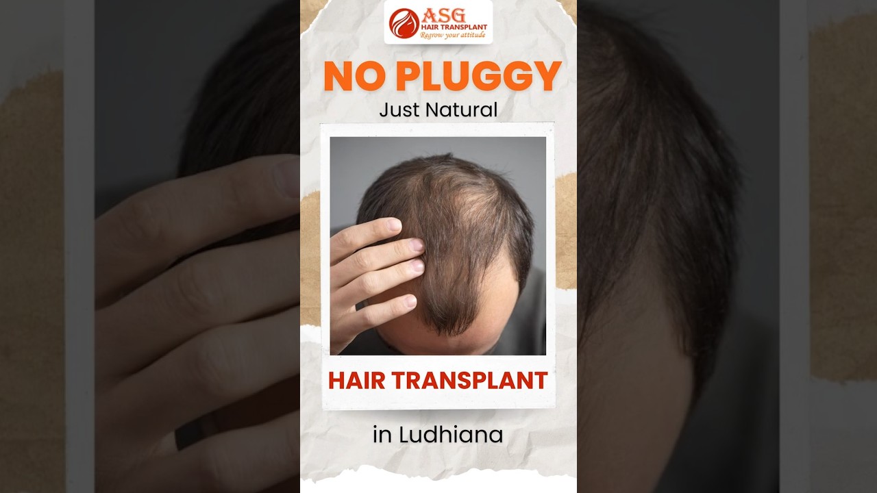 The Gold Standard in Hair Restoration: ASG Hair Transplant Centre in Jalandhar