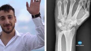 Witness Wrist Movement with Dynamic Digital Radiography (DDR) | Konica Minolta Healthcare