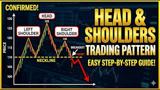 Head &amp; Shoulder Trading Pattern-with Past &amp; Live Example of WTI CRUDE OILThe Ultimate Beginner Guide