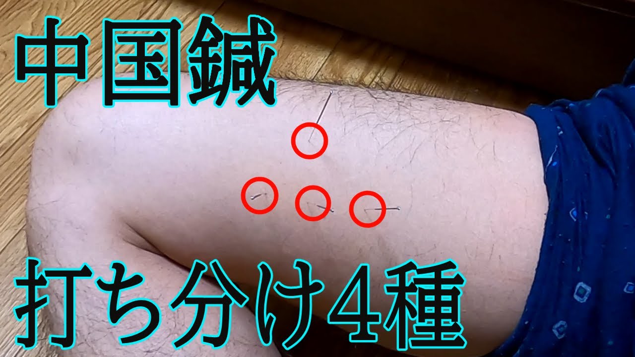 【中国鍼5番】打ち方 色々 - YouTube