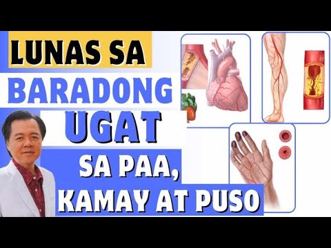 Video: Ano ang ugat Kali?