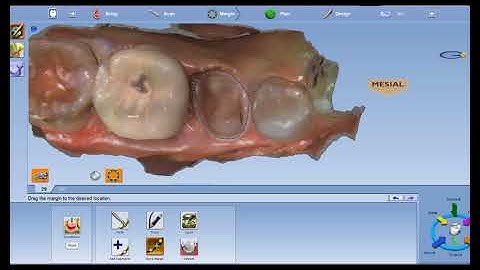 Using Trace to Mark Margins