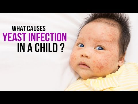 Video: Är griseofulvin säkert för spädbarn?