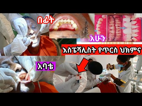 ቪዲዮ: የፀደይ የጥርስ ሀሮትን የፈጠረው ማን ነው?