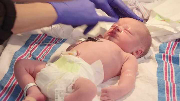 What's going on with my newborn's eyes? - DayDayNews