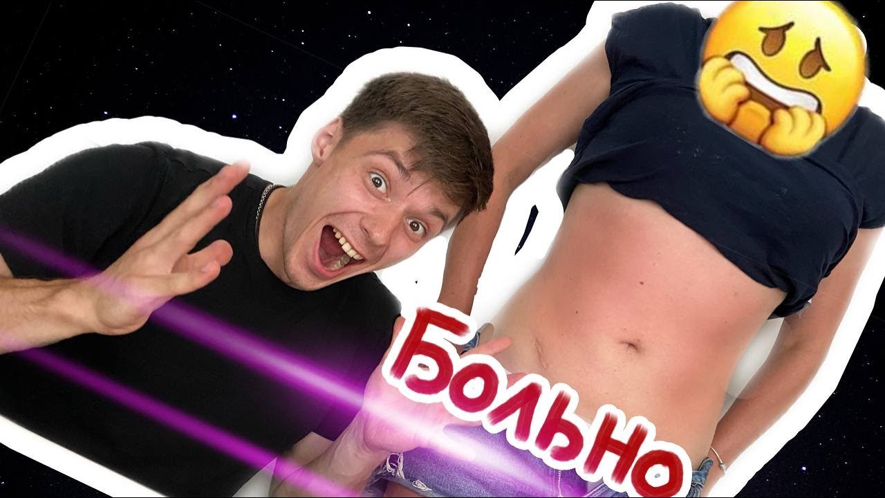 Armoplasty of the abdomen, manual liposuction. Армопластика живота ...