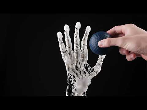 Allonic Hand Mk2