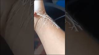 Exploring The Proboscis Of A Ribbon Worm A Sticky Situation