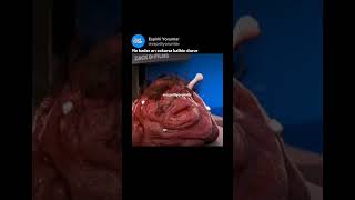 Ne Kadar Arı Sokarsa Kalbin Durur