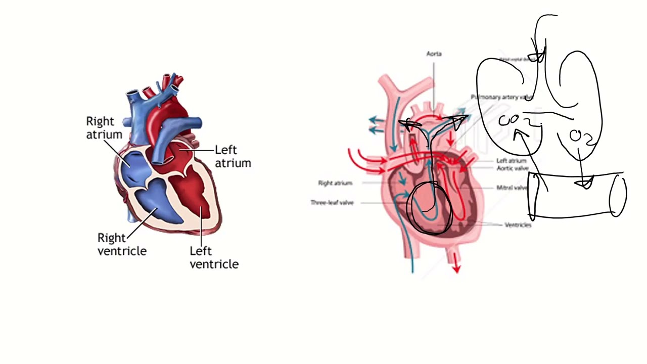 Congenital Heart Diseases