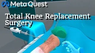 Total Knee Replacement Surgery on Meta Quest 3