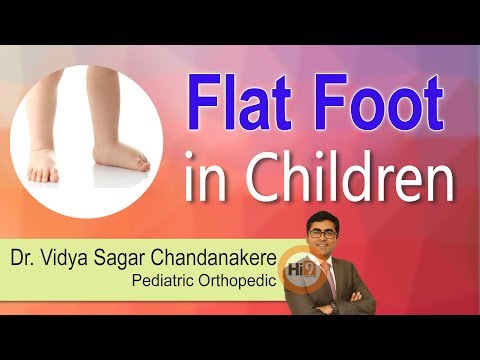 Flat foot in Children | Dr Vidya Sagar Chandanakere | Pediatric Orthopedic | Hi9