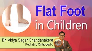 Flat Foot In Children Dr Vidya Sagar Chandanakere Pediatric Orthopedic Hi9