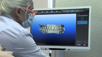 iTero® Orthodontic Scan Demo 2013