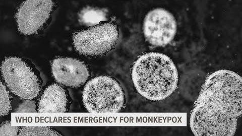 WHO declares monkeypox outbreak a global emergency; here