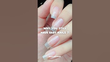 POV : You tried all Nail Growth tips BUT nothing work 🥲 ||