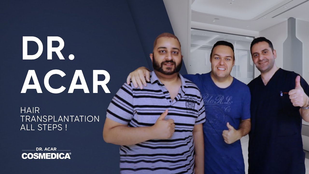 Hair Transplantation All Steps ! FUE + Needle Free Anesthesia with Dr.Acar