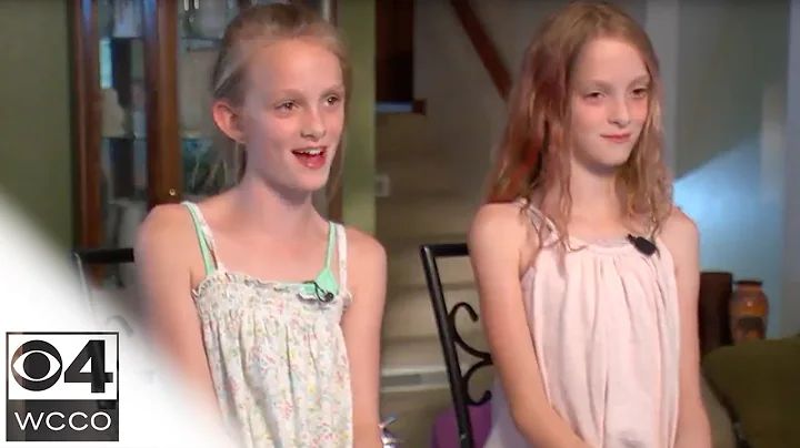 Conjoined Sisters Celebrate 10 Years Apart